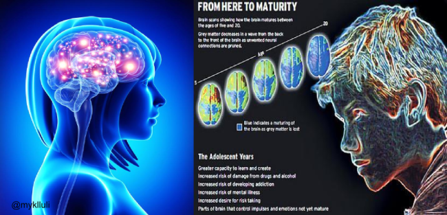 Brains Away Mature 32